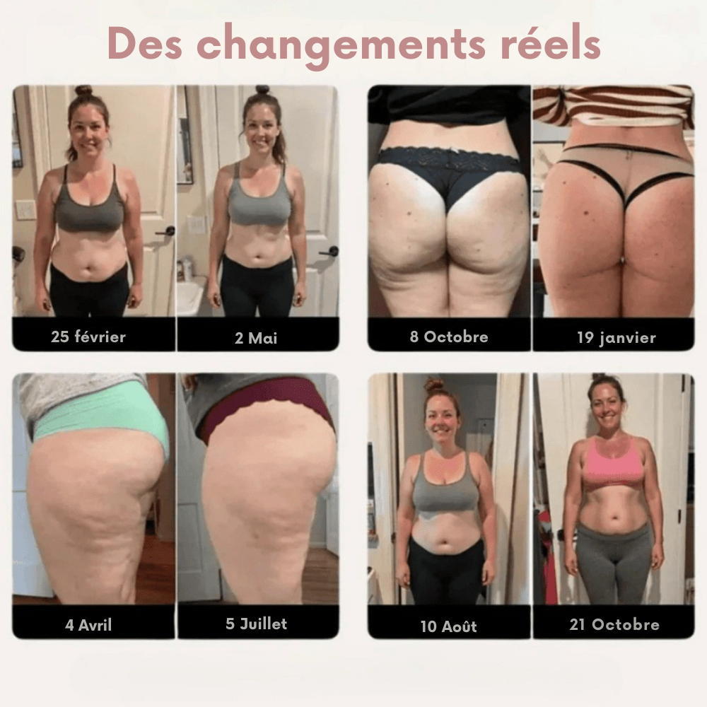 SculptFit™ | Leggings de sport qui rendent la cellulite invisible