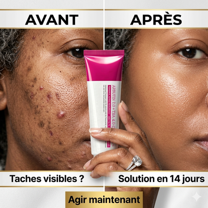 Crème coréenne avancée à l'arbutine et au TXA (Arbutin 7.0 + TXA 4.0)™